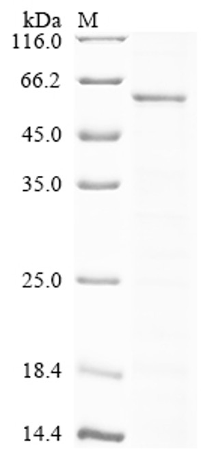 Recombinant Rabies virus Nucleoprotein (N) (CSB-YP325815RAJ)
