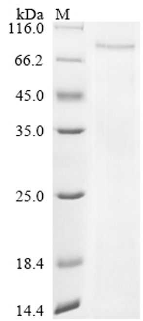 Recombinant Severe acute respiratory syndrome coronavirus 2 Nucleoprotein (N) (P13L,Δ31-33,R203K,G204R) (CSB-YP3325GMY(M18))