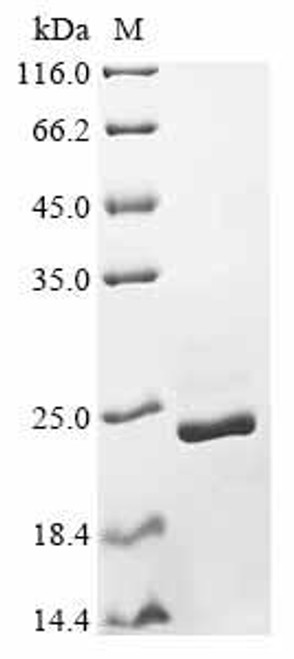 Recombinant Magnaporthe oryzae Cutinase (CUT1) (CSB-YP333519MPM)