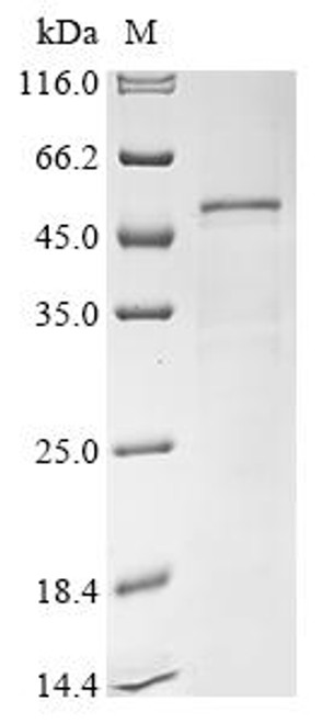 Recombinant Saccharomyces cerevisiae Adenosylmethionine-8-amino-7-oxononanoate aminotransferase (BIO3) (CSB-YP341874SVG)