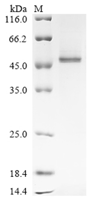 Recombinant Mouse Serine protease inhibitor A3K (Serpina3k) (CSB-YP362214MO)