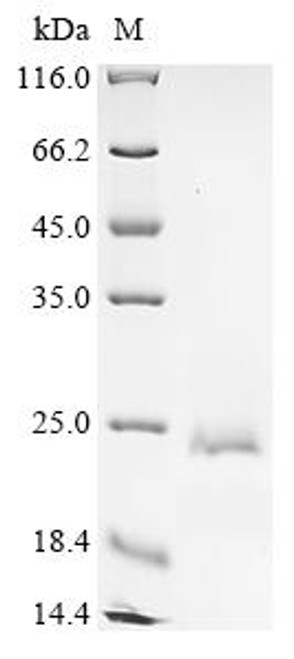 Recombinant Escherichia coli Type 1 fimbrin D-mannose specific adhesin (fimH) (V48C,L55C,R81P,N91S,S99N,T179P), partial (CSB-YP362349ENV1(M3))