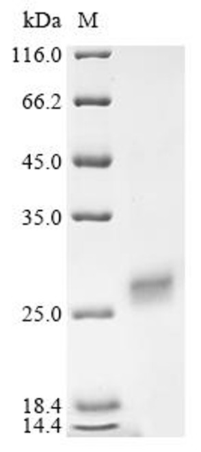 Recombinant Human Protein RRP5 homolog (PDCD11), partial (CSB-YP622782HU)