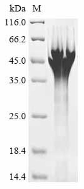 Recombinant Human B-cell CLL/lymphoma 7 protein family member A (BCL7A) (CSB-YP706319HU)
