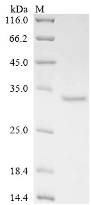 Recombinant Mouse Complement C1q tumor necrosis factor-related protein 6 (C1qtnf6) (CSB-YP753714MOc7)