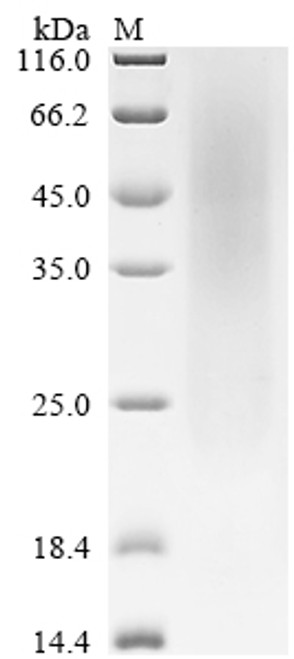 Recombinant Mouse Latent-transforming growth factor beta-binding protein 4 (Ltbp4), partial (CSB-YP813002MO)