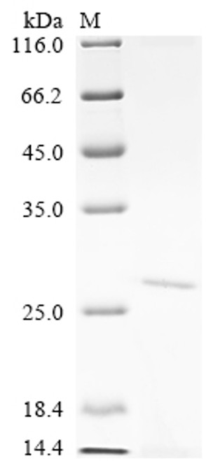 Recombinant Human 5' (3')-deoxyribonucleotidase, cytosolic type (NT5C) (CSB-YP837431HU)