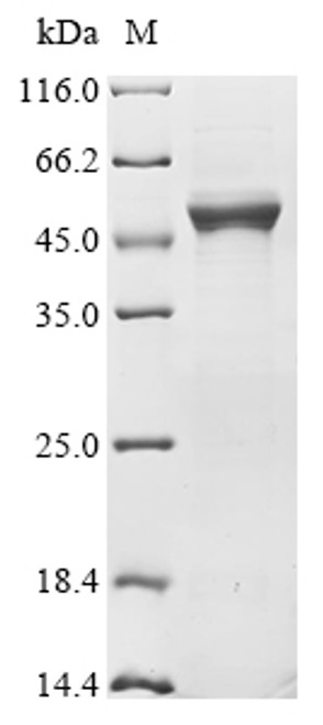 Recombinant Human Selenide, water dikinase 2 (SEPHS2) (U60S) (CSB-YP859104HU(M))