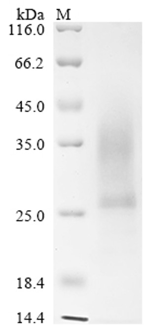 Recombinant Mouse Collagen triple helix repeat-containing protein 1 (Cthrc1) (CSB-YP875181MO)