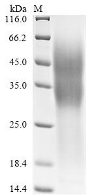 Recombinant Human Tumor necrosis factor receptor superfamily member 10D (TNFRSF10D), partial (CSB-YP887006HU)
