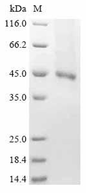 Recombinant Human Receptor-type tyrosine-protein kinase FLT3 (FLT3), partial (CSB-BP008733HU1) Recombinant Human Receptor-type tyrosine-protein kinase FLT3 (FLT3), partial (CSB-BP008733HU1)