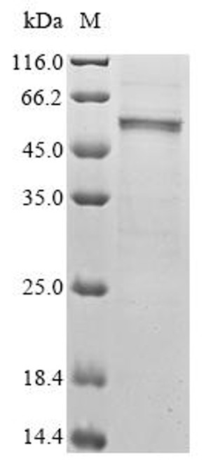 Recombinant Mouse Cis-aconitate decarboxylase (Acod1) (CSB-BP011825MO) Recombinant Mouse Cis-aconitate decarboxylase (Acod1) (CSB-BP011825MO)