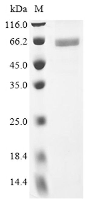 Recombinant Human N-myc proto-oncogene protein (MYCN) (CSB-BP015278HUc7)