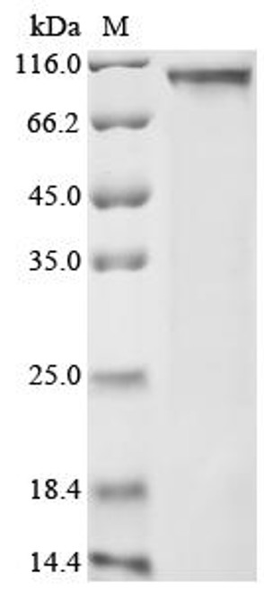 Recombinant Human NACHT, LRR and PYD domains-containing protein 6 (NLRP6) (CSB-BP015874HU(A4)) Recombinant Human NACHT, LRR and PYD domains-containing protein 6 (NLRP6) (CSB-BP015874HU(A4))