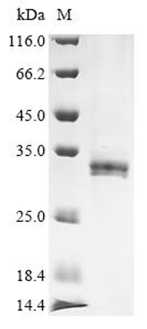 Recombinant Drosophila melanogaster Nuclear RNA export factor 2 (nxf2), partial (CSB-BP016219DLU) Recombinant Drosophila melanogaster Nuclear RNA export factor 2 (nxf2), partial (CSB-BP016219DLU)