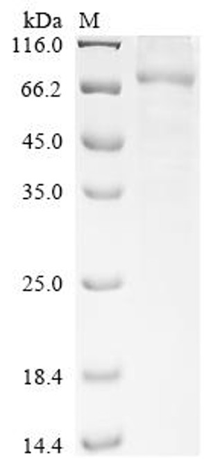 Recombinant Severe acute respiratory syndrome coronavirus 2 Replicase polyprotein 1ab (rep), partial (CSB-BP3420GND)