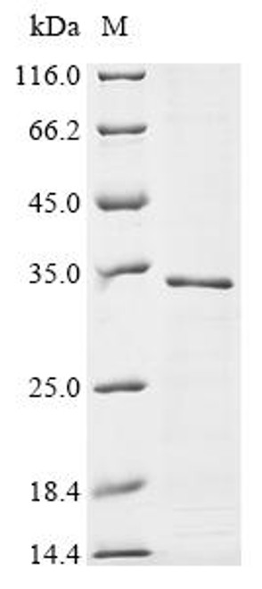Recombinant Rat Synaptoporin (Synpr) (CSB-CF023023RA)