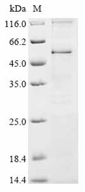 Recombinant Rat Synaptotagmin-2 (Syt2) (CSB-CF023038RA) Recombinant Rat Synaptotagmin-2 (Syt2) (CSB-CF023038RA)