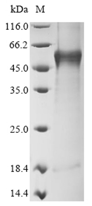 Recombinant Mouse Tyrosinase (Tyr) (CSB-CF025394MO) Recombinant Mouse Tyrosinase (Tyr) (CSB-CF025394MO)