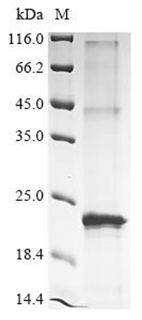 Recombinant Streptomyces coelicolor pH-gated potassium channel KcsA (kcsA) (CSB-CF358316FOB) Recombinant Streptomyces coelicolor pH-gated potassium channel KcsA (kcsA) (CSB-CF358316FOB)