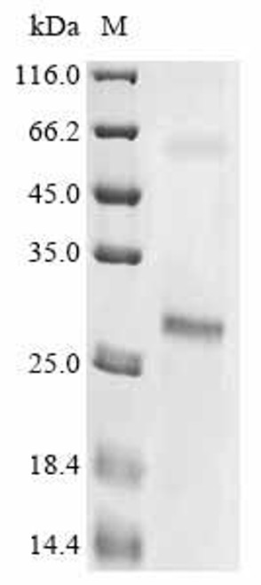 Recombinant Larimichthys crocea Odorant receptor (CSB-CF4478GSC) Recombinant Larimichthys crocea Odorant receptor (CSB-CF4478GSC)