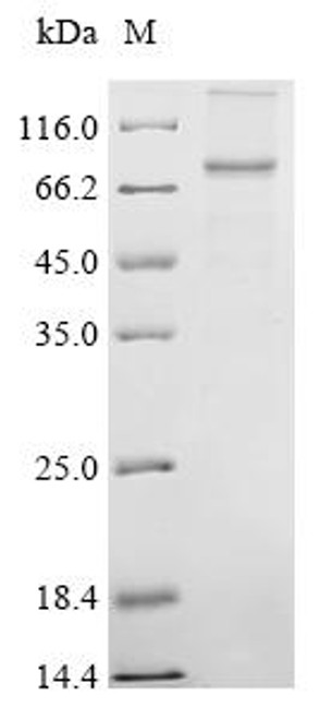 Recombinant Coxiella burnetii Hypothetical membrane spanning protein (CBU_1863) (CSB-CF4560DXP) Recombinant Coxiella burnetii Hypothetical membrane spanning protein (CBU_1863) (CSB-CF4560DXP)