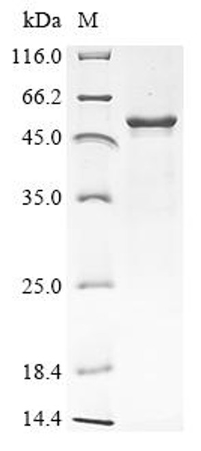 Recombinant Rat Protein cereblon (Crbn) (CSB-CF710067RA)