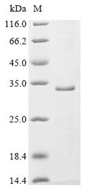 Recombinant Rat Synaptogyrin-1 (Syngr1) (CSB-CF730813RA)