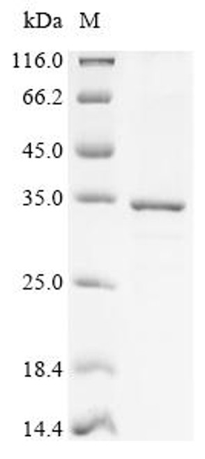 Recombinant Human Mitochondrial thiamine pyrophosphate carrier (SLC25A19) (CSB-CF864025HU)