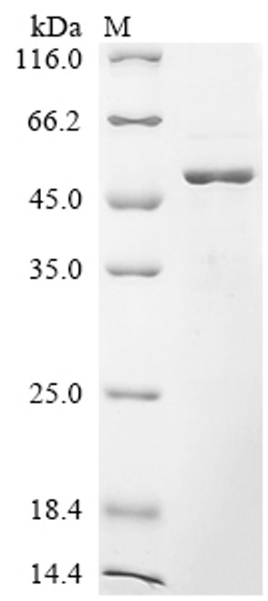 Recombinant Human Serpin E3 (SERPINE3) (CSB-EP021083HU)