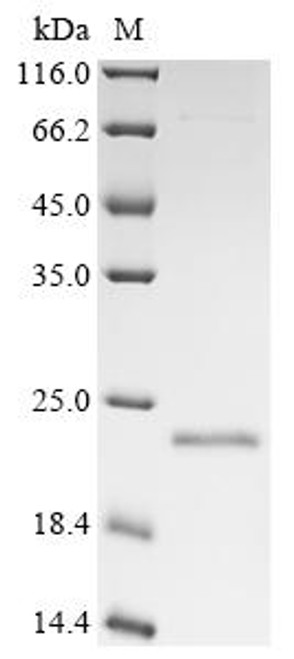 Recombinant Rotavirus Non-structural glycoprotein 4, partial (CSB-EP435796RIRa0)