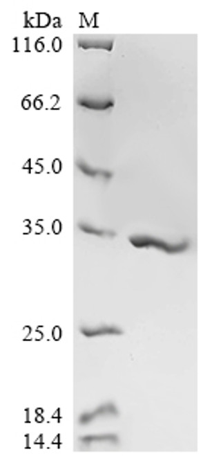 Recombinant Human cytomegalovirus Enhanced green fluorescent protein (egfp) (V164A,S176G) (CSB-EP2069HIZ(M))
