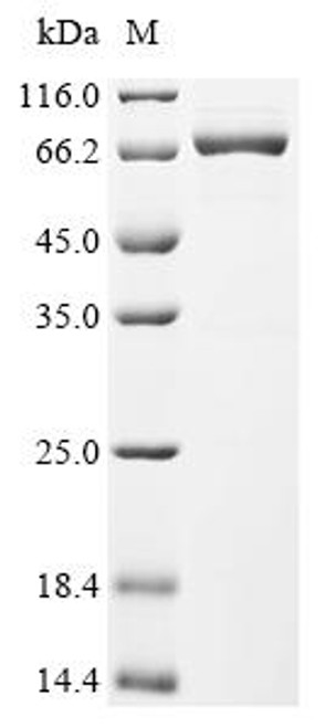 Recombinant Human cytomegalovirus Immediate early protein IE1 (UL123) (CSB-EP522280HWW)