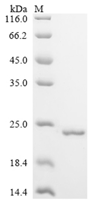 Recombinant Human Plexin-B1 (PLXNB1), partial (CSB-EP018222HU)