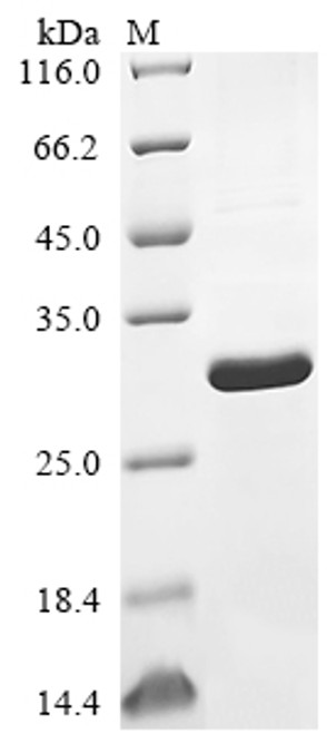 Recombinant Human Bcl-2-like protein 11 (BCL2L11) (CSB-EP002615HUa0)
