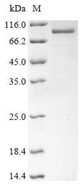 Recombinant Moloney murine leukemia virus Gag-Pol polyprotein (gag-pol), partial (CSB-EP361030MHK)