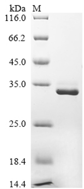 Recombinant Human Calbindin (CALB1) (CSB-EP004432HU)