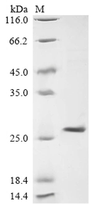 Recombinant Lymphocytic choriomeningitis virus Pre-glycoprotein polyprotein GP complex (GPC), partial (CSB-EP362127LKZ1c7) Recombinant Lymphocytic choriomeningitis virus Pre-glycoprotein polyprotein GP complex (GPC), partial (CSB-EP362127LKZ1c7)