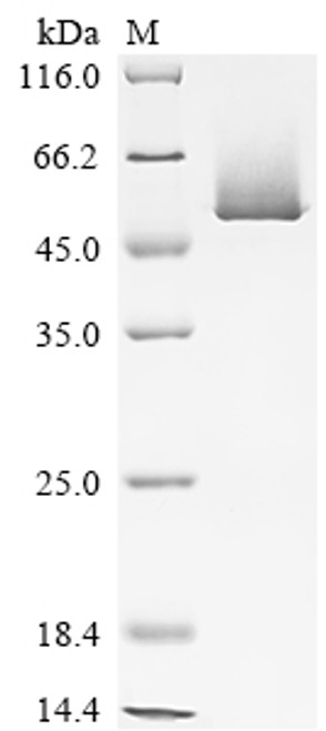 Recombinant Mouse Serine protease inhibitor A3K (Serpina3k) (CSB-EP362214MO)