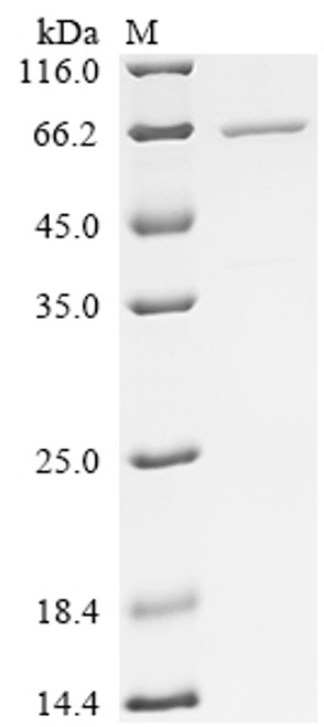 Recombinant Escherichia coli Minor curlin subunit (csgB), Biotinylated (CSB-EP359633ENV-B)