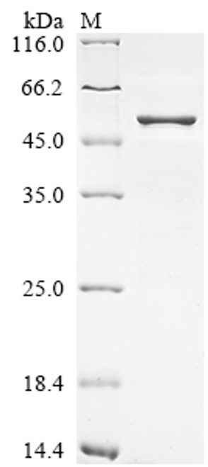 Recombinant Severe acute respiratory syndrome coronavirus 2 Nucleoprotein (N) (P13L,Δ31-33,P151S,R203K,G204R,S413R), partial (CSB-EP3325GMY(M20))