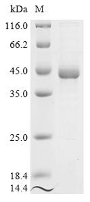 Recombinant Human Nuclear receptor subfamily 2 group F member 6 (NR2F6) (CSB-EP016058HUe1)