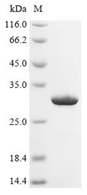 Recombinant Clostridium difficile Chloramphenicol acetyltransferase (catD) (CSB-EP320005DUN)