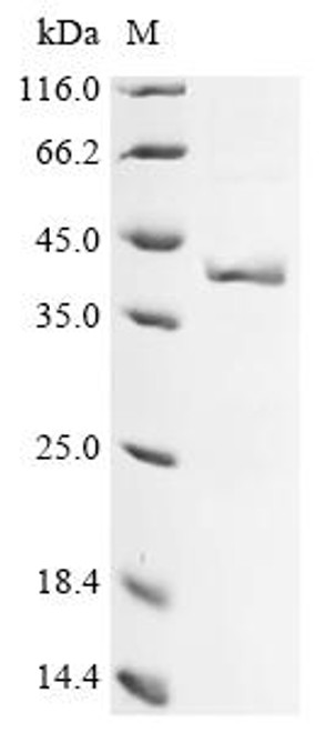 Recombinant Oryza sativa subsp. japonica Glutelin type-B 4 (GLUB4), partial (CSB-EP320397OFG)
