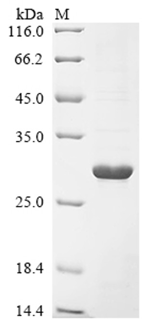 Recombinant Magnaporthe oryzae Cutinase (CUT1) (CSB-EP333519MPMa0)