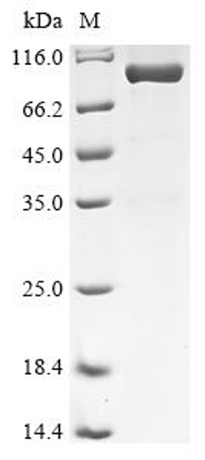 Recombinant Human Dual specificity mitogen-activated protein kinase kinase 3 (MAP2K3), Biotinylated (CSB-EP013412HU-B)