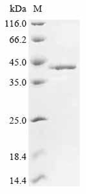 Recombinant Mouse Fos-related antigen 1 (Fosl1) (CSB-EP008792MO)