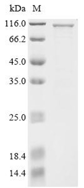Recombinant Human Gasdermin-D (GSDMD), Biotinylated (CSB-EP009956HU-B)