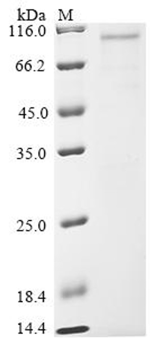 Recombinant Mycobacterium tuberculosis Serine/threonine-protein kinase pknF (pknF) (CSB-EP302592MVZ)