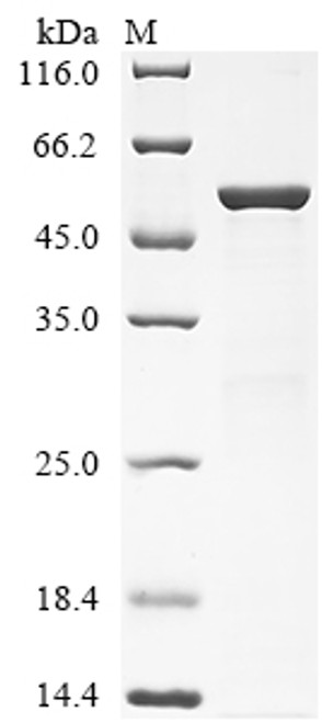 Recombinant Mycobacterium tuberculosis Steroid C26-monooxygenase (cyp125) (CSB-EP351308MVZb0)